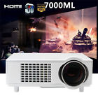 My09oyzc617700 Unbranded-generic 7000 Lum Led